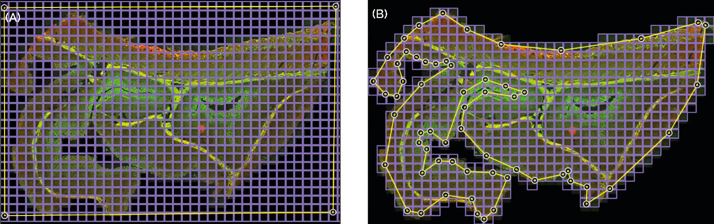 Irregular montage comparison showing standard montage and optimized irregular montage acquisition patterns