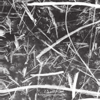 TEM image of crocidolite fibres